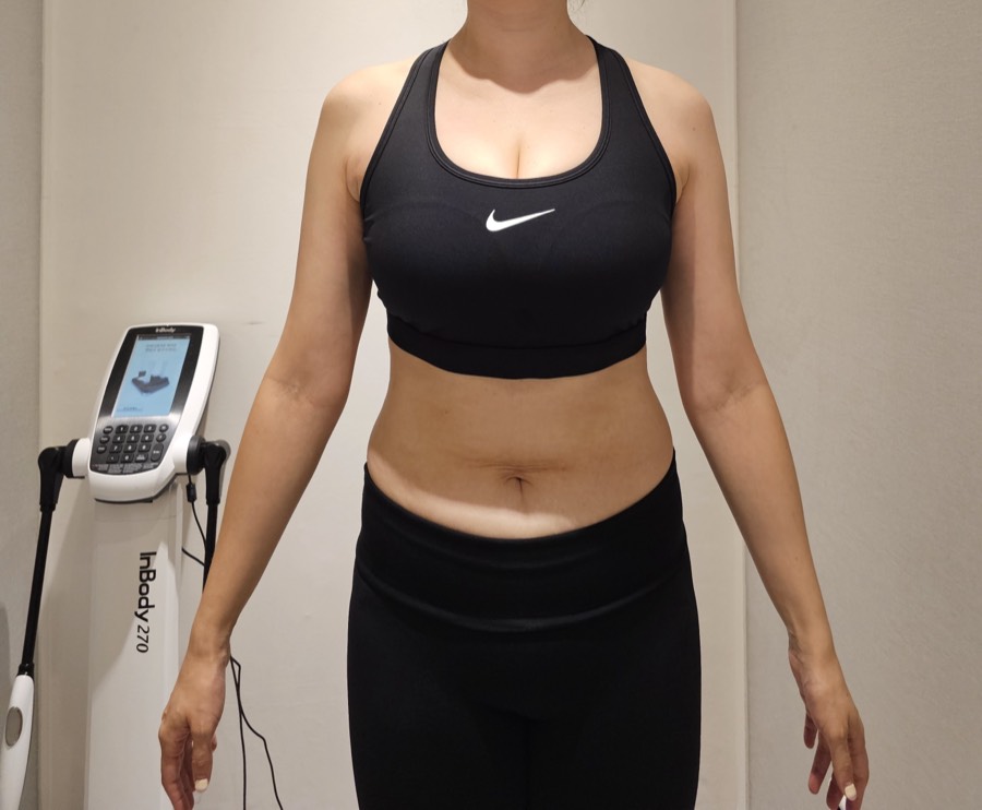여성 회원 · 복부 개선 (정면) After