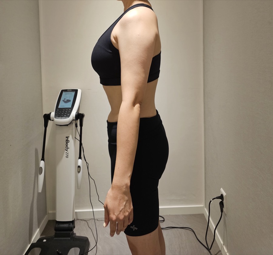 여성 회원 · 복부 개선 (측면) After